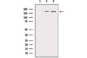 Western blot analysis of extracts from various samples, using VPRBP Antibody. (VPRBP 抗体)