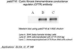 Image no. 2 for anti-Cystic Fibrosis Transmembrane Conductance Regulator (ATP-Binding Cassette Sub-Family C, Member 7) (CFTR) (N-Term) antibody (ABIN559719) (CFTR 抗体  (N-Term))