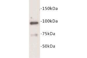 Western Blotting (WB) image for anti-Junctophilin 2 (JPH2) antibody (ABIN1854929) (Junctophilin 2 抗体)