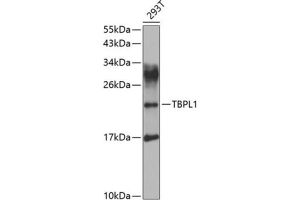 TBPL1 抗体  (AA 1-186)