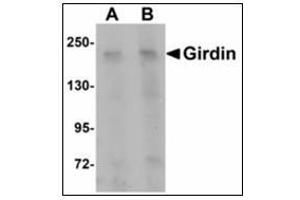 Western blot analysis of Girdin in rat brain tissue lysate with Girdin antibody at (A) 1 and (B) 2 µg/ml. (Girdin 抗体  (C-Term))