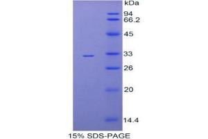 SDS-PAGE analysis of Mouse TBG Protein. (SERPINA7 蛋白)