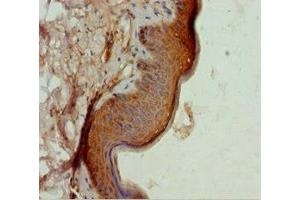 Immunohistochemistry of paraffin-embedded human skin tissue using ABIN7172703 at dilution of 1:100 (TAF9 抗体  (AA 1-264))