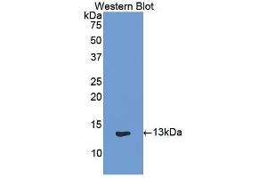 Western Blotting (WB) image for anti-Keratin 1 (KRT1) (AA 489-625) antibody (ABIN1859571) (Cytokeratin 1 抗体  (AA 489-625))