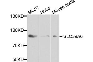 Western blot analysis of extracts of various cell lines, using SLC39A6 antibody (ABIN5972625) at 1/1000 dilution. (SLC39A6 抗体)