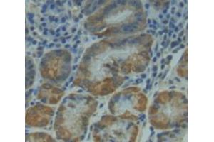 IHC-P analysis of Kidney tissue, with DAB staining. (NUAK1 抗体  (AA 421-658))