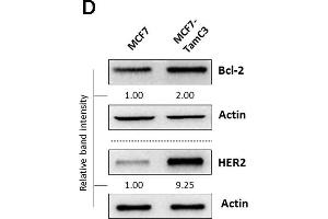 Western Blotting (WB) image for anti-B-Cell CLL/lymphoma 2 (BCL2) (N-Term) antibody (ABIN2857047)