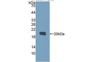 Western Blotting (WB) image for Matrix Metallopeptidase 9 (Gelatinase B, 92kDa Gelatinase, 92kDa Type IV Collagenase) (MMP9) ELISA Kit (ABIN6574164)