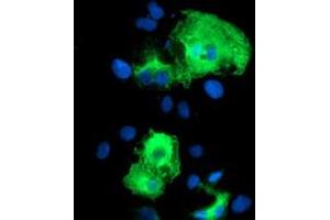 Anti-SCHIP1 mouse monoclonal antibody (ABIN2455645) immunofluorescent staining of COS7 cells transiently transfected by pCMV6-ENTRY SCHIP1 (RC206269). (SCHIP1 抗体)