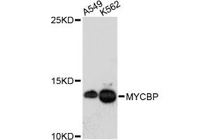 Western blot analysis of extracts of various cell lines, using MYCBP antibody. (MYCBP 抗体)