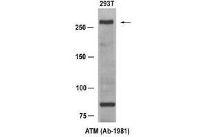 Western blot analysis of extract from 293T cells, using ATM (Ab-1981) Antibody (E021147). (ATM 抗体)