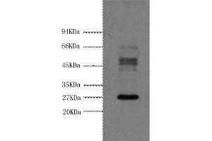 Western Blot analysis of Hela cells using Galectin 3 Monoclonal Antibody at dilution of 1:3000. (Galectin 3 抗体)