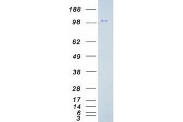 FAK Protein (Transcript Variant 1) (Myc-DYKDDDDK Tag)