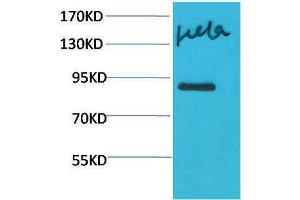 Western Blotting (WB) image for anti-Signal Transducer and Activator of Transcription 4 (STAT4) antibody (ABIN3179122) (STAT4 抗体)