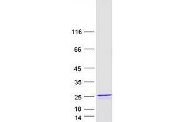 ZNF580 Protein (Transcript Variant 3) (Myc-DYKDDDDK Tag)