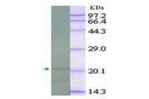 Image no. 2 for anti-Interleukin 18 (IL18) antibody (ABIN791564) (IL-18 抗体)