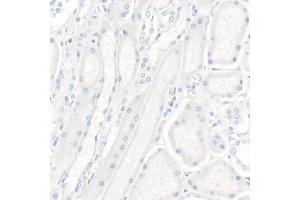Immunohistochemistry of paraffin-embedded Human kidney (negative control sample) using CR2/CD21 Rabbit mAb (ABIN1678995, ABIN3015431, ABIN3015432 and ABIN7101406) at dilution of 1:200 (40x lens). (CD21 抗体)