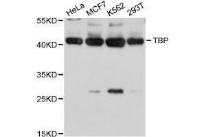 Western blot analysis of extracts of various cell lines, using TBP antibody (ABIN5971218) at 1/1000 dilution. (TBP 抗体)