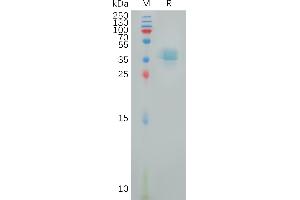 Human PT Protein, hFc Tag on SDS-PAGE under reducing condition. (PTGER4 Protein (AA 1-19) (Fc Tag))