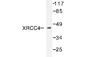 Image no. 1 for anti-X-Ray Repair Complementing Defective Repair in Chinese Hamster Cells 4 (XRCC4) antibody (ABIN271982) (XRCC4 抗体)