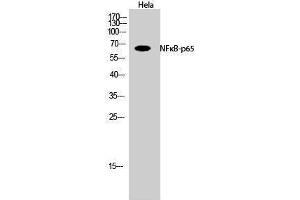 Western Blotting (WB) image for anti-Nuclear Factor-kB p65 (NFkBP65) (Thr735) antibody (ABIN3185891) (NF-kB p65 抗体  (Thr735))