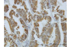 Immunostaining (ISt) image for anti-Nodal Homolog (NODAL) (AA 275-346) antibody (ABIN562016)