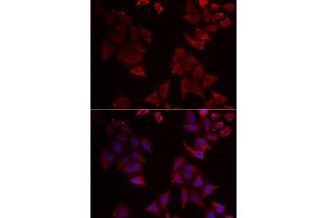 Immunofluorescence analysis of U2OS cells using NCR1 antibody. (NCR1 抗体)