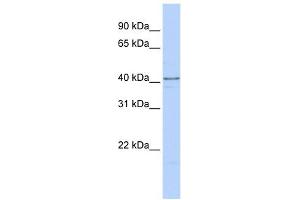 HNRPDL antibody used at 1 ug/ml to detect target protein. (HNRPDL 抗体  (C-Term))