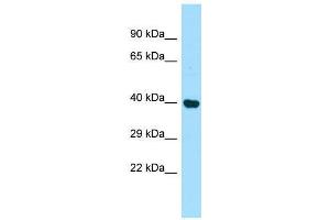 Host:  Rabbit  Target Name:  Pdcd2  Sample Type:  Rat Kidney lysates  Antibody Dilution:  1. (PDCD2 抗体  (Middle Region))