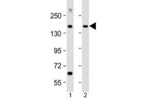 Western blot testing of human 1) brain and 2) lung lysate with MTUS1 antibody at 1:2000. (MTUS1 抗体  (AA 183-226))