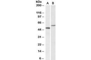 Western blot testing of human hippocampus [A] and HeLa [B] lysates with CD47 antibody at 0. (CD47 抗体)