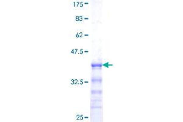 SOX10 Protein (AA 336-433) (GST tag)