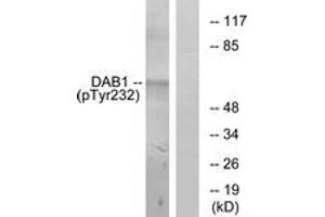 Western blot analysis of extracts from LOVO cells, using Dab1 (Phospho-Tyr232) Antibody. (DAB1 抗体  (pTyr232))