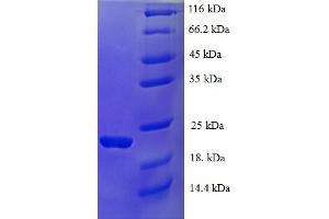 IFNA21 Protein (AA 24-189) (His tag)