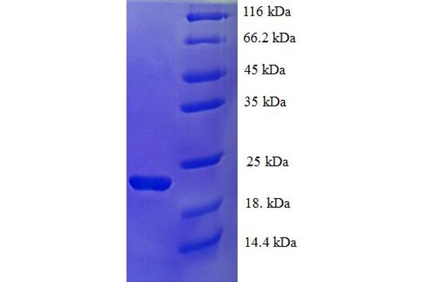 IFNA21 Protein (AA 24-189) (His tag)