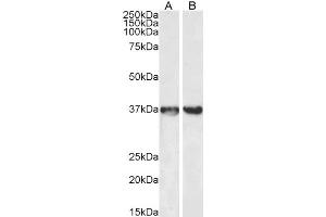 Western Blotting (WB) image for anti-Glyceraldehyde-3-Phosphate Dehydrogenase (GAPDH) (C-Term) antibody (ABIN185240)