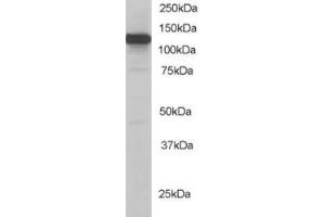Western Blotting (WB) image for anti-Kinesin Family Member 5B (KIF5B) (C-Term) antibody (ABIN2465236) (KIF5B 抗体  (C-Term))