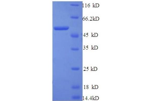 Tyrosinase-Related Protein 1 Protein (TYRP1) (AA 82-333, partial) (GST tag)