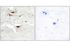 Immunohistochemistry analysis of paraffin-embedded human brain tissue, using IPPK Antibody. (IPPK 抗体  (AA 11-60))