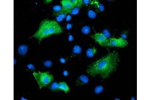Immunofluorescence (IF) image for anti-ADP-Ribosylation Factor GTPase Activating Protein 1 (ARFGAP1) antibody (ABIN1496684) (ARFGAP1 抗体)