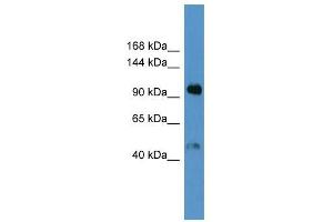 Western Blot showing Lp (a) antibody used at a concentration of 1-2 ug/ml to detect its target protein. (Lp(a) 抗体  (Middle Region))