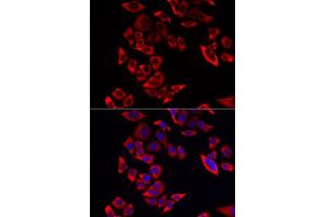 Immunofluorescence analysis of MCF-7 cell using RPL9 antibody. (RPL9 抗体)