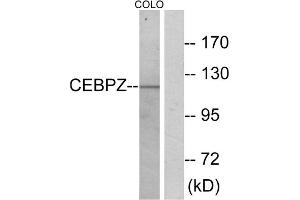 Western blot analysis of extracts from COLO cells, using C/EBP zeta antibody. (DDIT3 抗体  (N-Term))