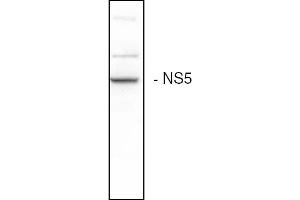 Western blot analysis of the HCV NS5B expression in Huh7 cells (Hepatitis C Virus 抗体)
