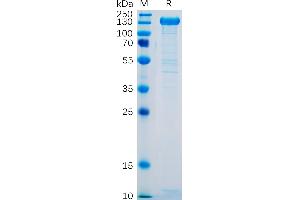 P-Selectin Protein (AA 42-771) (Fc Tag)