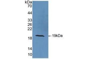 Detection of Recombinant SOD1, Ovine using Polyclonal Antibody to Superoxide Dismutase 1 (SOD1) (SOD1 抗体  (AA 2-152))