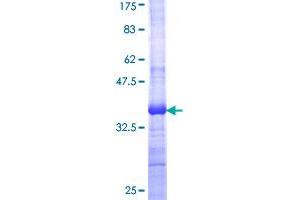 WNT7B Protein (AA 241-349) (GST tag)