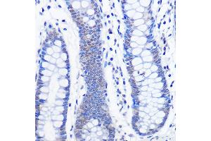 Immunohistochemistry of paraffin-embedded human colon using AhR Rabbit mAb (ABIN7265679) at dilution of 1:100 (40x lens). (Aryl Hydrocarbon Receptor 抗体)