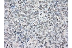 Immunohistochemical staining of paraffin-embedded colon tissue using anti-PPP5Cmouse monoclonal antibody. (PP5 抗体)