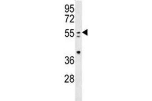 PAX-7 antibody western blot analysis in mouse spleen tissue lysate (PAX7 抗体  (AA 410-437))